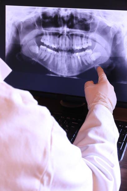 Best Emergency Dental Care for Broken or Chipped Teeth in Brightwaters, NY