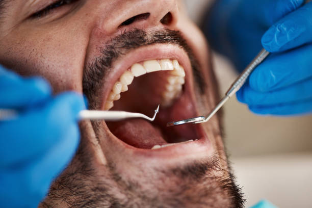 Best Cosmetic Emergency Dentistry in Brightwaters, NY